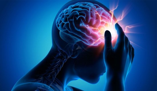 Người phụ nữ đối diện với nguy cơ vỡ động mạch não do đau đỉnh đầu liên tục trong 6 năm  - Ảnh 2.
