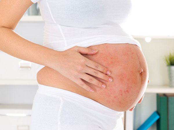 Triệu chứng bệnh sởi khi mang thai xuất hiện theo từng giai đoạn