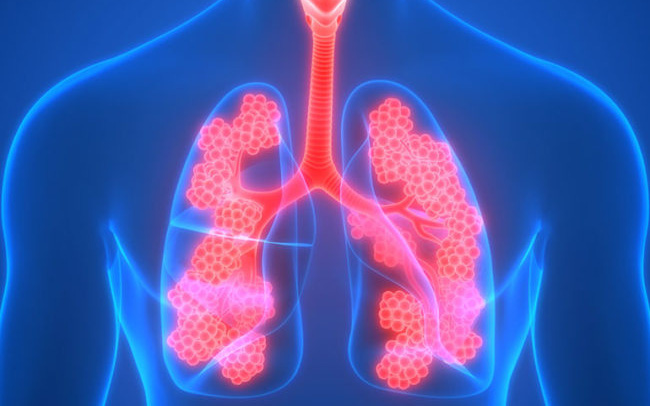 Tiêm vắc-xin phòng tránh bệnh phổi tắc nghẽn mãn tính (COPD)