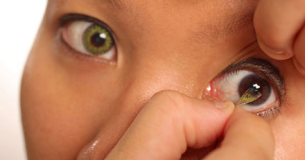 Đau mắt đỏ do kính áp tròng: Nguyên nhân, dấu hiệu nhận biết và cách điều trị - Ảnh 2.