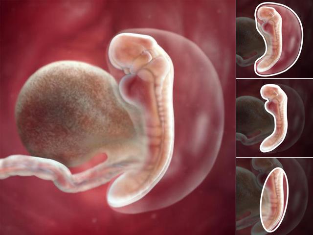 Siêu âm thai 18 tuần có thể phát hiện các loại dị tật thai nhi nào