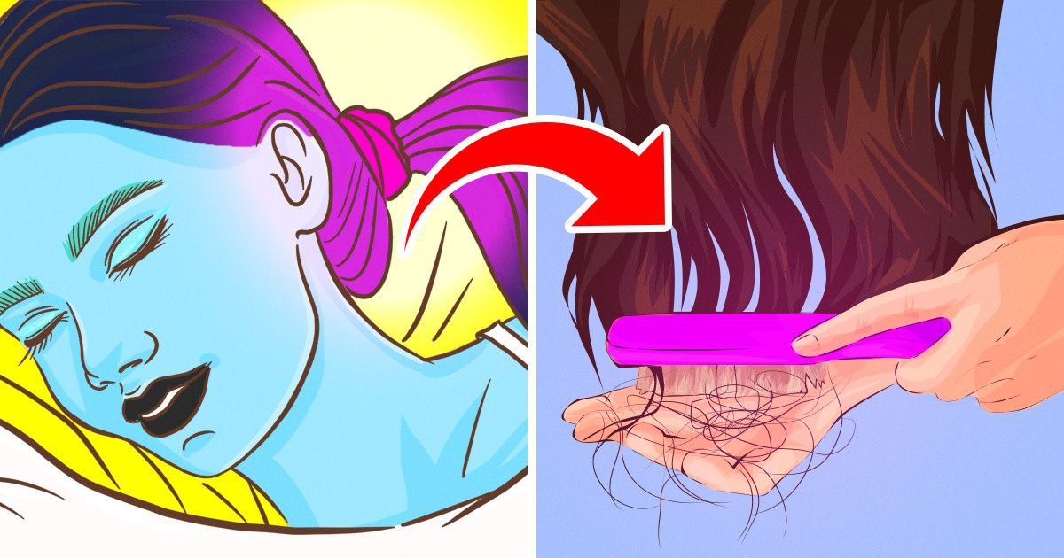 Dừng ngay thói quen buộc gọn tóc khi ngủ bởi nó có thể gây ra 2 vấn đề sức khỏe vô cùng tai hại - Ảnh 1.
