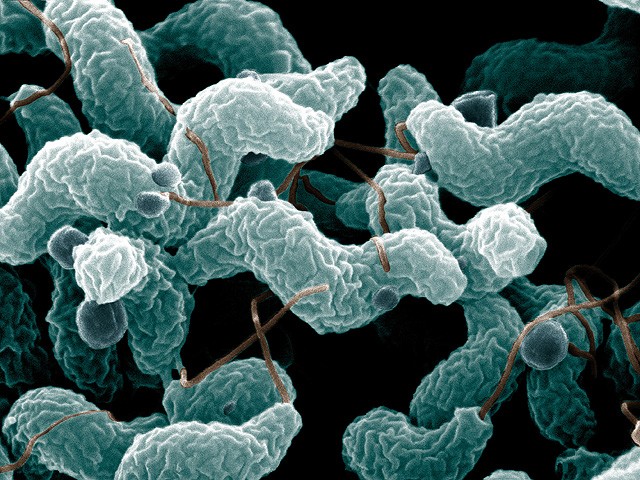 Điểm danh 7 loại vi khuẩn gây ngộ độc phổ biến - Ảnh 3.