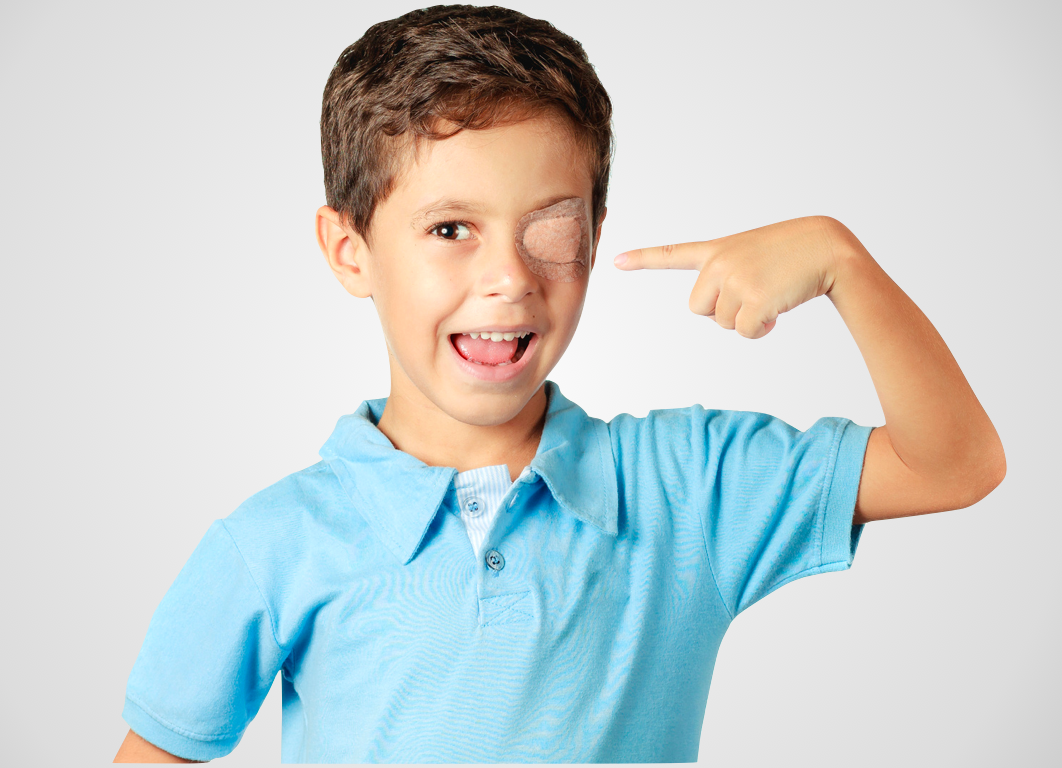 Nhược thị do biến chứng cận thị: Khó phát hiện do không có biểu hiện rõ ràng! - Ảnh 3.