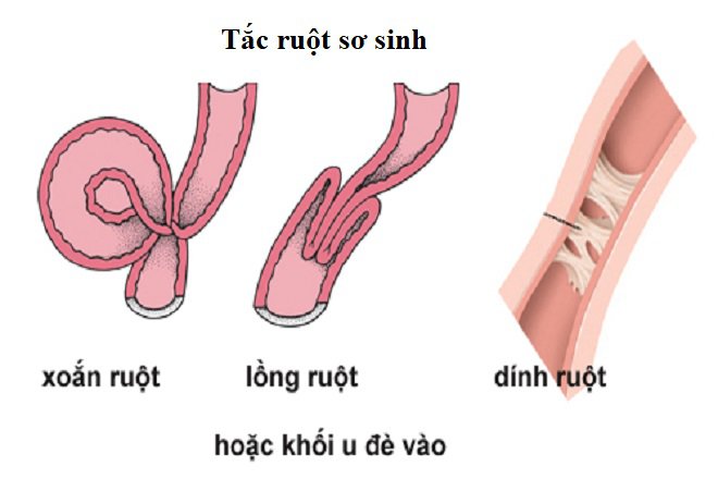 Chế Độ Ăn Uống Và Phòng Ngừa