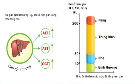 Chỉ số GGT là gì? Người bệnh có biết chỉ số GGT bao nhiêu là nguy hiểm?