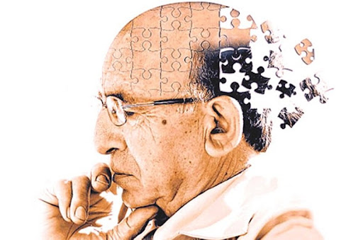 Bệnh teo não ở người già: Nguyên nhân, dấu hiệu, biến chứng và cách điều trị - Ảnh 1.