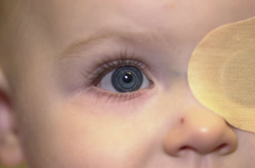 Biến chứng mắt do bệnh Rubella bẩm sinh - Ảnh 1.