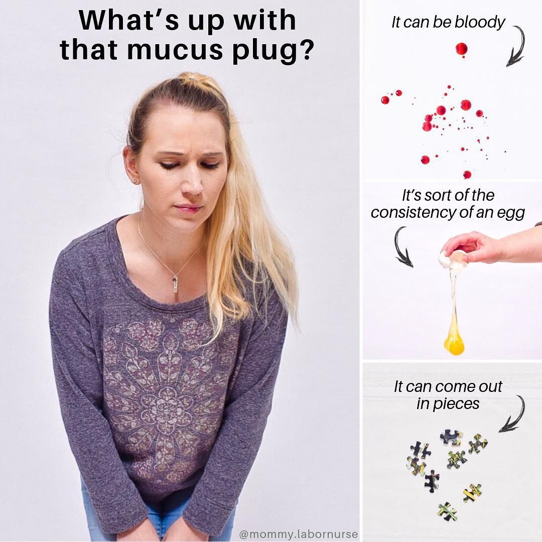 Bung nút nhầy là gì? Mẹ bầu cần biết gì về hiện tượng bung nút nhầy? - Ảnh 2.