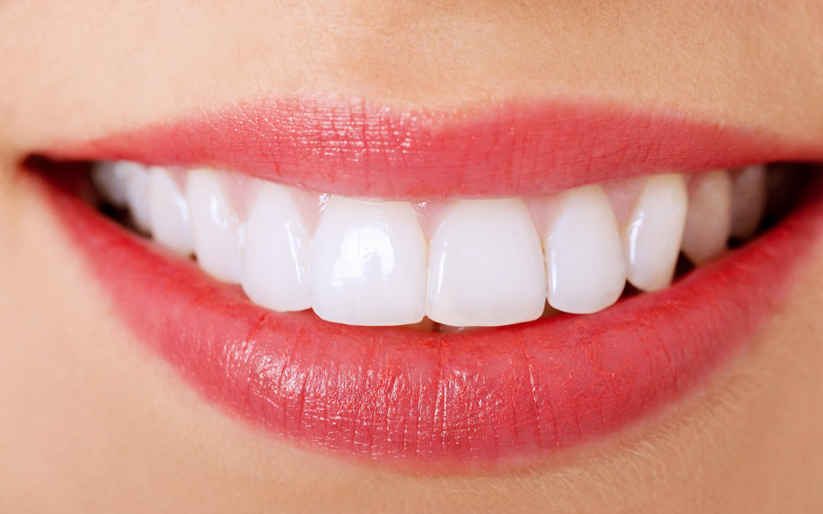Mẹo làm đẹp: Mách bạn cách làm trắng răng tại nhà hiệu quả nhất ...