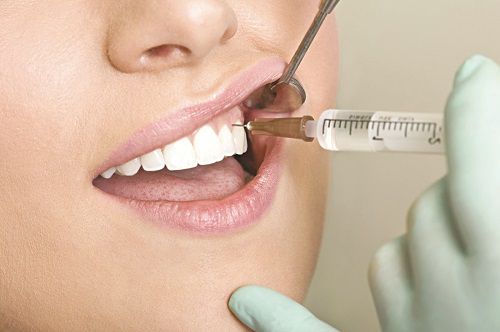 Răng khôn bị sâu có nguy hiểm hay không? Dấu hiệu và cách xử lý - Ảnh 3.