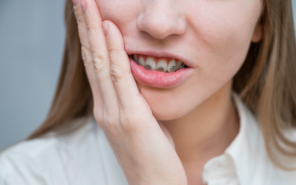 Điểm danh những tác hại của niềng răng có thể bạn chưa biết