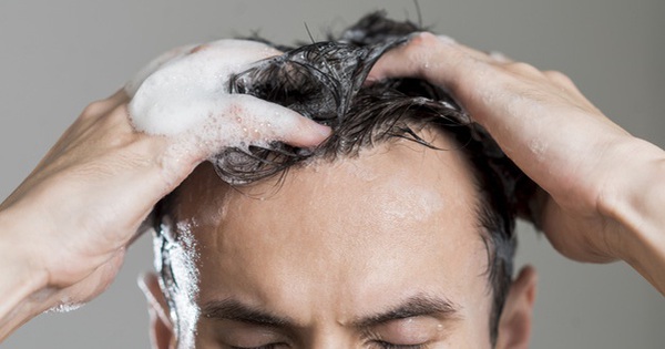 Cách chăm sóc tóc cho người bị nấm da đầu vào mùa đông - Ảnh 3.
