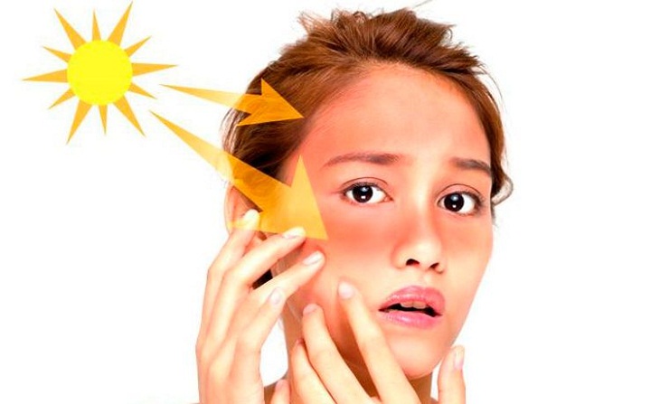 Da nổi đốm nâu không ngứa - Ảnh 2. Da nổi đốm nâu không ngứa - Ảnh 2.