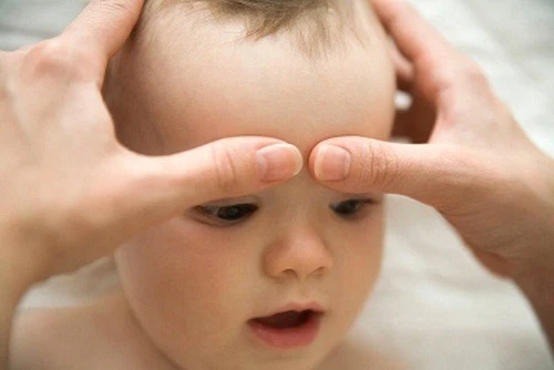 Bé bị nổi cục u mềm trên đầu do đâu? Đây là dấu hiệu cảnh báo bệnh lý nào ở trẻ? - Ảnh 4.