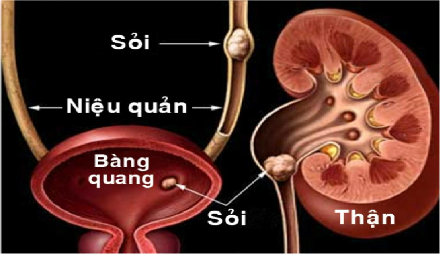 CÂY RÂU MÈO CÓ TÁC DỤNG GÌ?  - Ảnh 2.