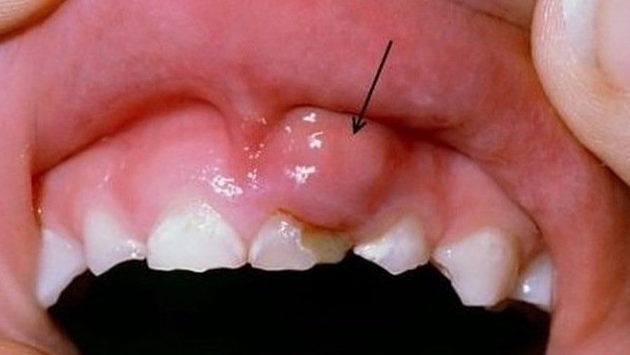 7 biểu hiện của ung thư miệng thường gặp - Ảnh 1.