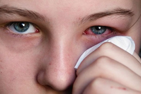 4 phương pháp chữa ung thư mắt - cứu tinh cho bệnh nhân trong giai đoạn điều trị - Ảnh 2.