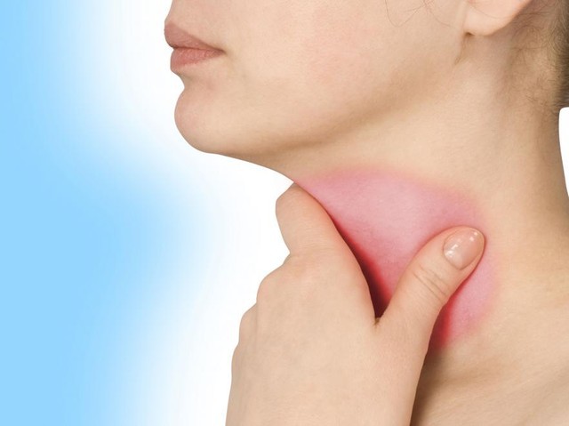 Dấu hiệu ung thư vòm họng dễ nhầm lẫn với dấu hiệu của bệnh cảm cúm - Ảnh 2.