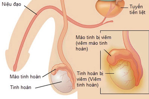 Ảnh 2.