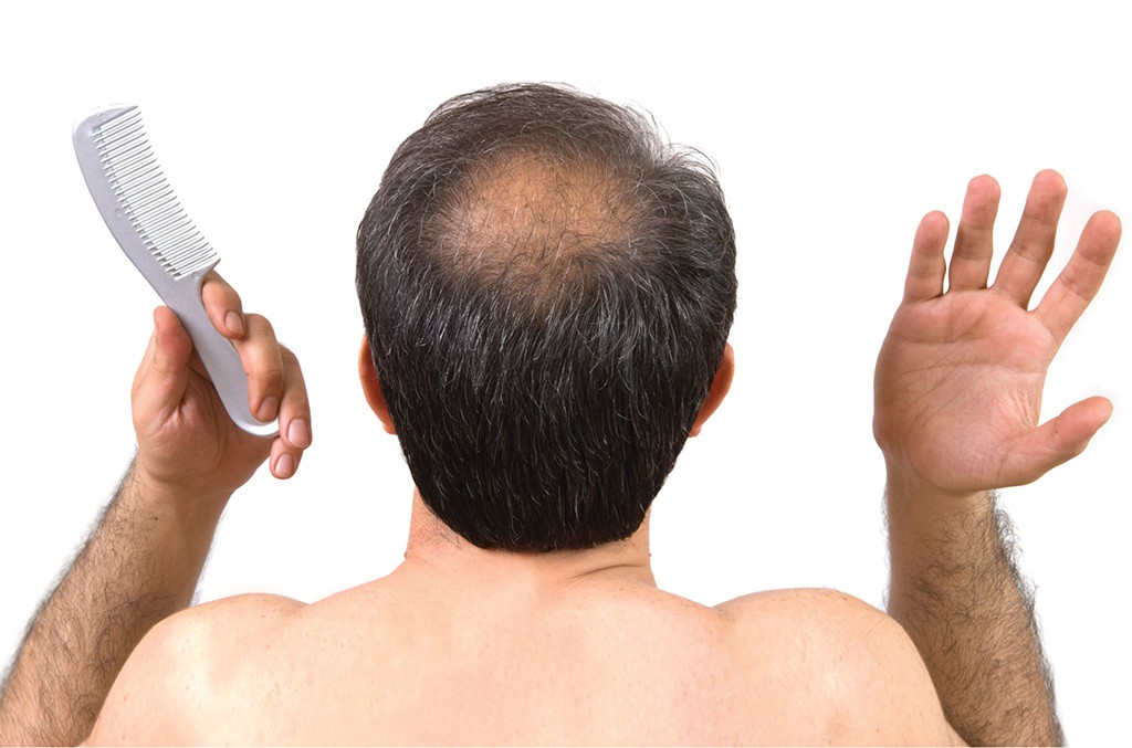 Chăm sóc tóc cho nam giới  Những điều cần biết  THE MEN SQUARE