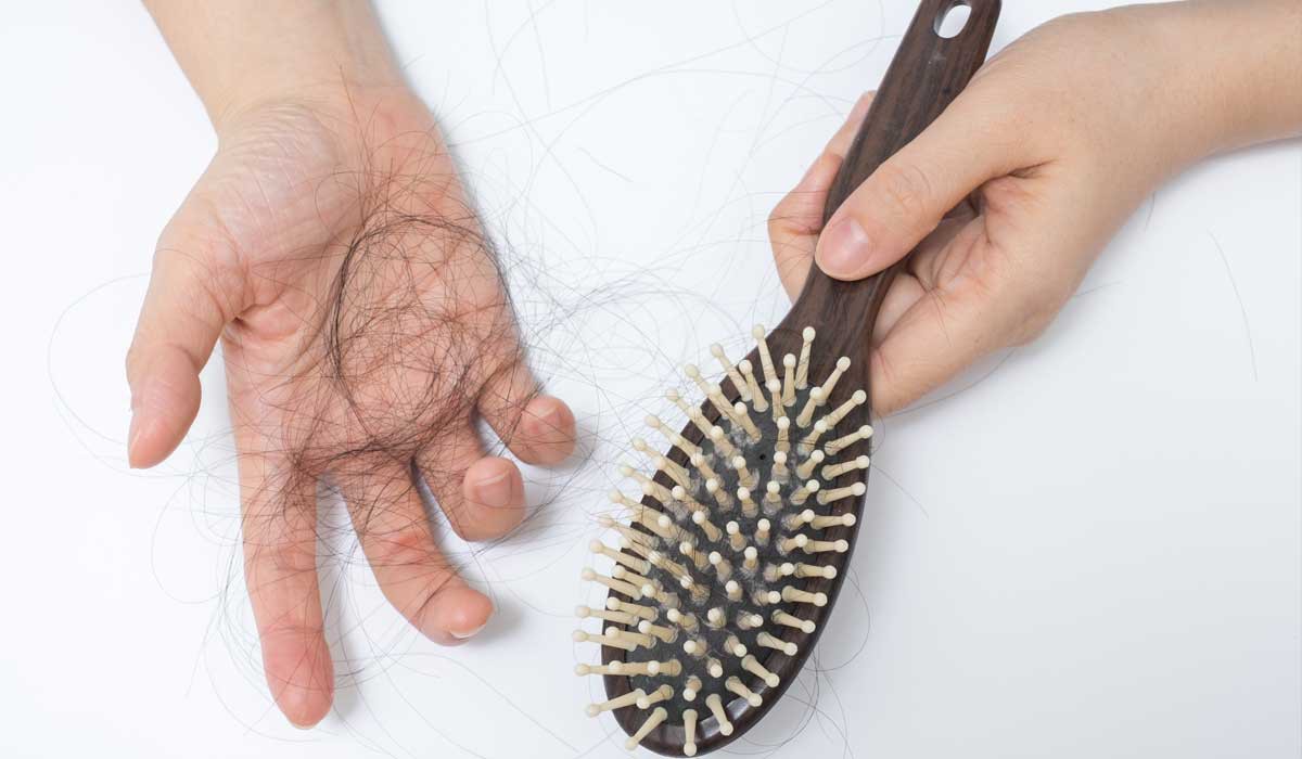 Rụng tóc nhiều là triệu chứng của bệnh lý gì?