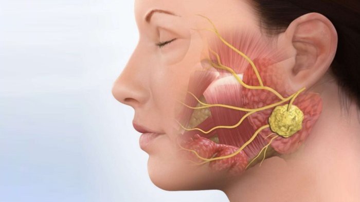 Dấu hiệu ung thư vòm họng dễ nhầm lẫn với dấu hiệu của bệnh cảm cúm - Ảnh 4.