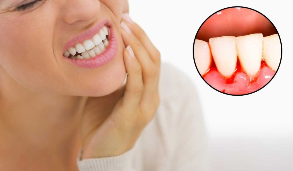 Chảy máu chân răng Nguyên nhân, dấu hiệu và cách phòng ngừa-2