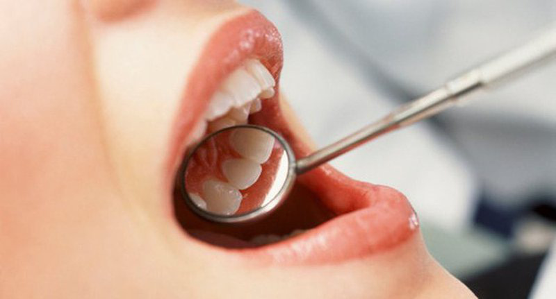 Chảy máu chân răng Nguyên nhân, dấu hiệu và cách phòng ngừa-6