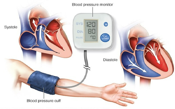 Những bệnh lý có thể phát triển khi huyết áp được đo đạc ở mức 140/80 mmHg trong thời gian dài là gì?
