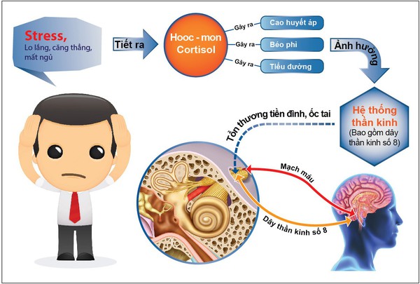 Rối loạn tiền đình - Nguyên nhân và Cách phòng tránh tốt nhất Phan-biet-roi-loan-tien-dinh-va-thieu-nang-tuan-hoan-nao