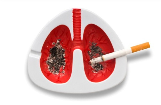 Bệnh phổi đặc biệt nguy hiểm, cần bảo vệ phổi mùa thu bằng cách nào? - Ảnh 5.
