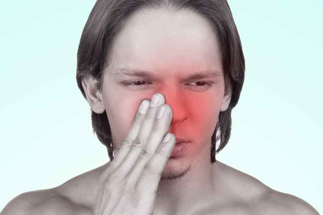 Đau nhức mũi trong viêm xoang và những điều cần biết - Ảnh 1.