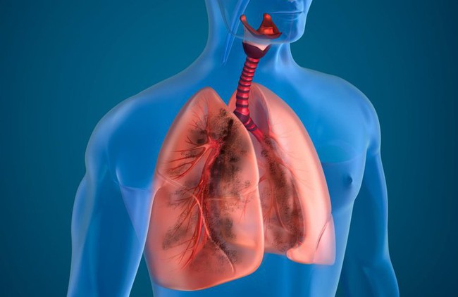 Tại sao COPD gây khó thở? Làm thế nào để kiểm soát khó thở do COPD? - Ảnh 1.