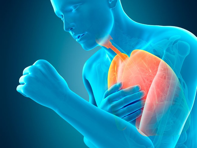 4 lưu ý giúp bạn tránh xa bệnh phổi tắc nghẽn mãn tính (COPD) - Ảnh 1.