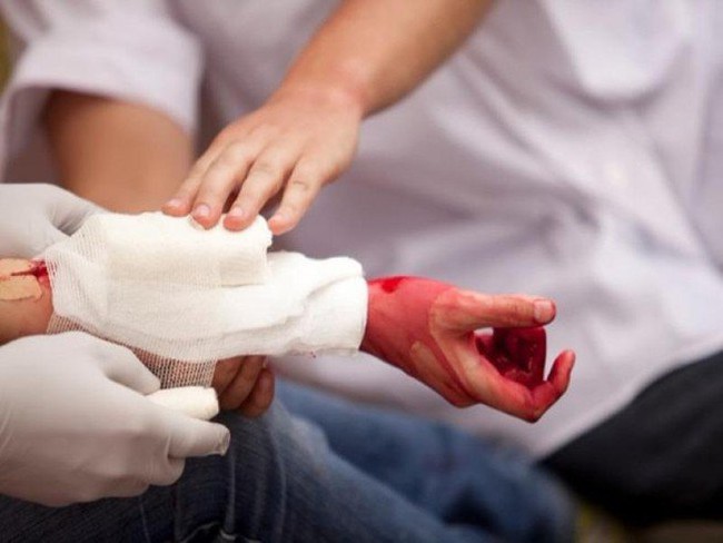 Vết thương hở: Sai lầm khi cầm máu và hướng dẫn cầm máu đúng cách khi bị thương - Ảnh 4.