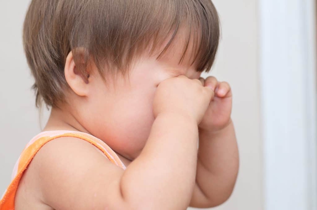 Bệnh đau mắt đỏ: Những điều cần biết về bệnh đau mắt đỏ ở trẻ em - Ảnh 7.