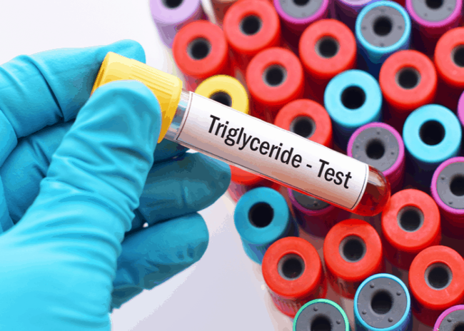 Triglyceride là gì? Biến chứng và cách kiểm soát căn bệnh này - Ảnh 3.