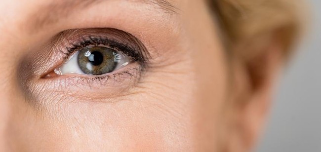 Phân biệt đau mắt đỏ và tăng nhãn áp để điều trị đúng cách - Ảnh 2.