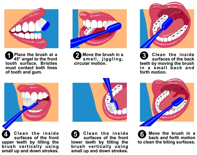 Tìm hiểu những biện pháp chăm sóc sức khỏe răng miệng đúng cách - Ảnh 2.