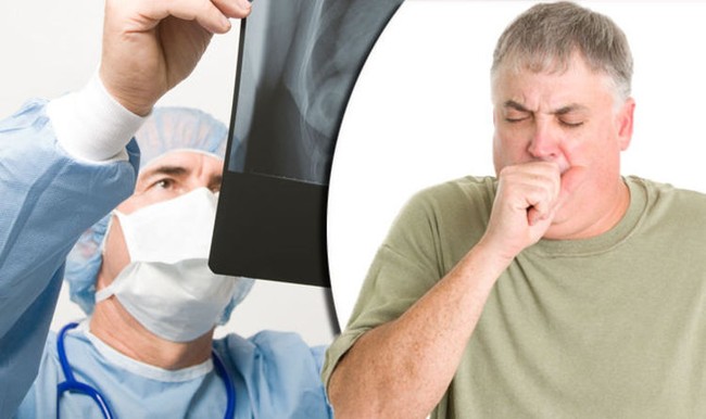 COPD và suy tim: Triệu chứng là gì và chúng liên quan như thế nào? - Ảnh 4.