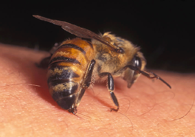 Nhiều người bị ong đốt gây sốc phản vệ nguy hiểm, cần làm gì khi bị ong đốt? - Ảnh 3.