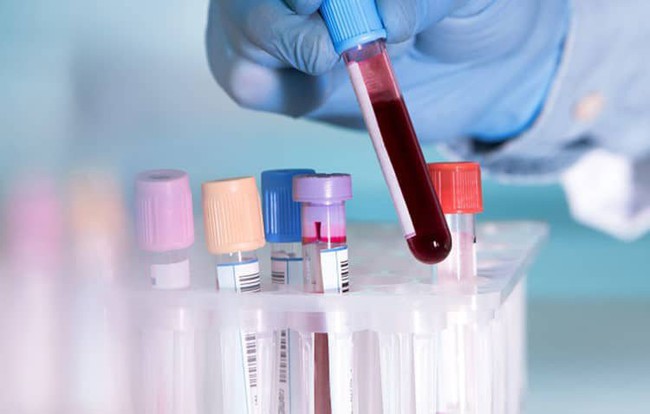 Kỹ thuật xét nghiệm máu để chẩn đoán viêm phế quản - Ảnh 2.