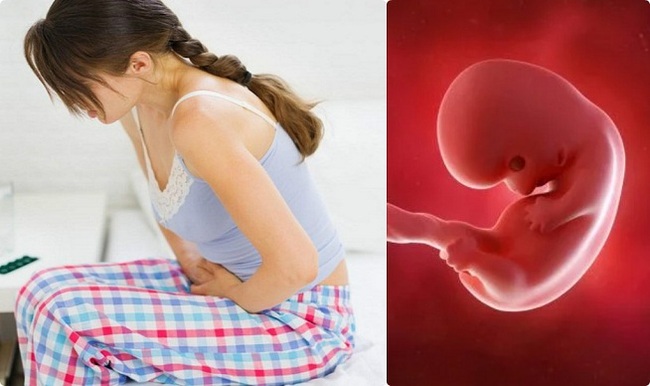 Ảnh hưởng của bệnh hen phế quản đối với thai nhi - Ảnh 3.