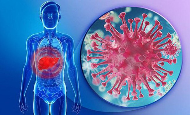 Virus viêm gan B có thể tiến triển thành bệnh xơ gan nếu không phát hiện sớm - Ảnh 2.