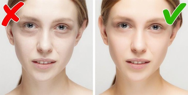 4 dấu hiệu bất thường trên gương mặt chứng tỏ bạn đang bị thiếu chất - Ảnh 2.