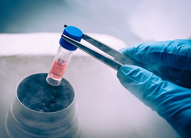 Tế bào gốc là gì và tác dụng của tế bào gốc đối với chữa bệnh - Ảnh 2.