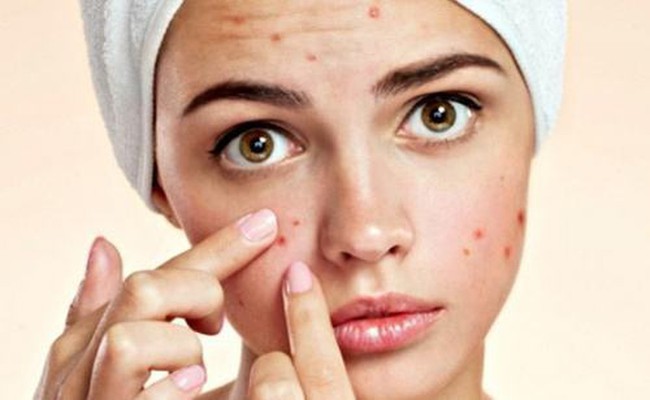 Cẩn trọng với một số căn bệnh về da thường gặp vào mùa hè  - Ảnh 2.