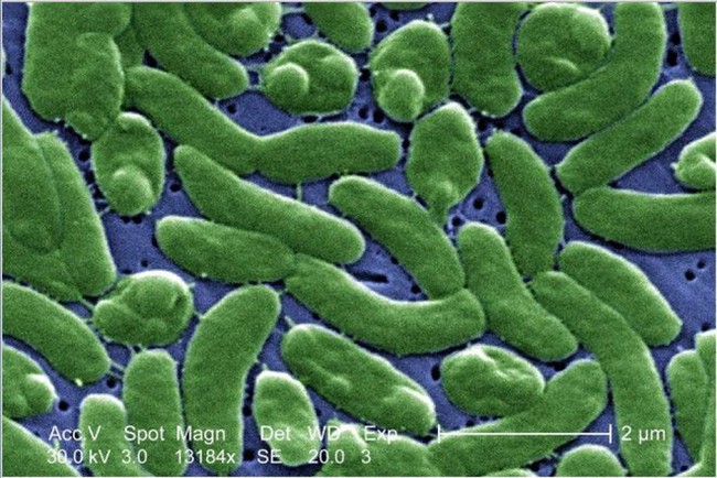 Cảnh báo vi khuẩn ăn thịt người từ món hàu sống và cách chế biến hàu an toàn - Ảnh 3.