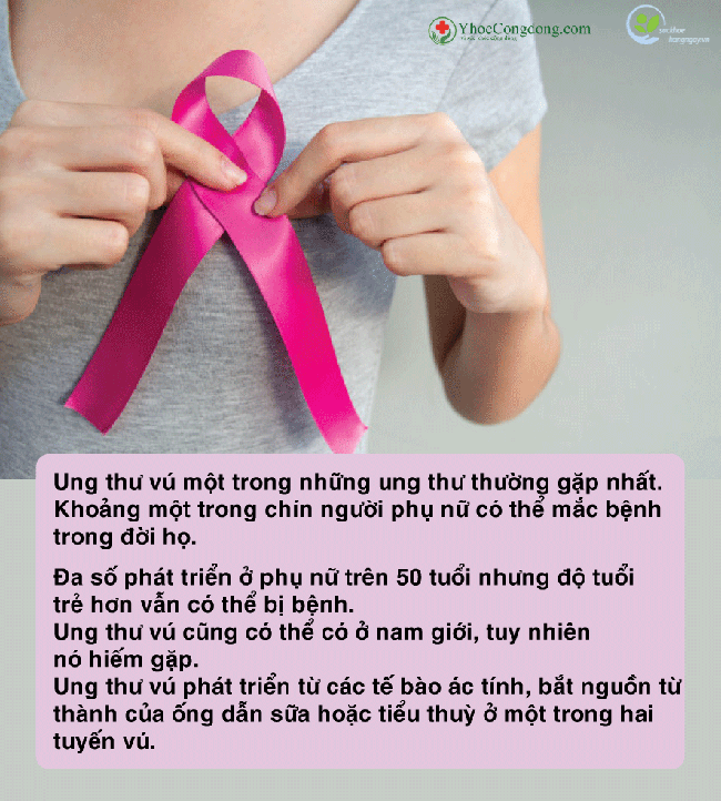 Các kiến thức cơ bản về ung thư vú bạn nên biết - Ảnh 1.